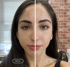 Lymphatic Facial Brush Massage