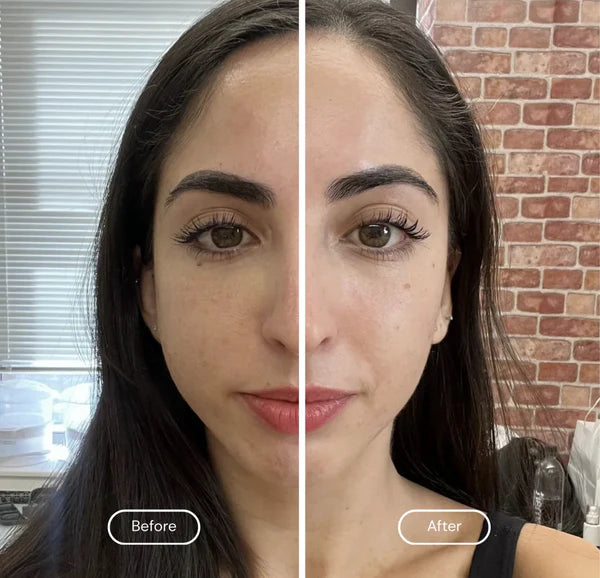 Lymphatic Facial Brush Massage