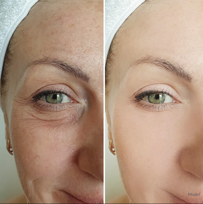 Puridi Eye Renewal Patches